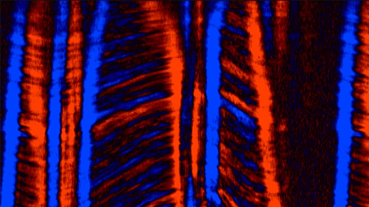 En illustrasjon som viser hjertemuskelvev avbildet ved ekkokardiografi med høy bildefrekvens