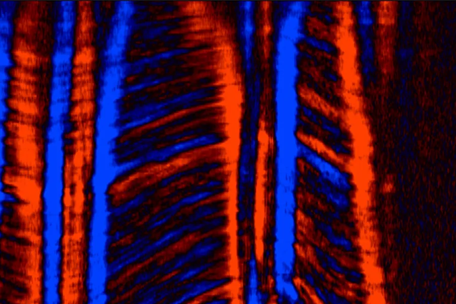 En illustrasjon som viser hjertemuskelvev avbildet ved ekkokardiografi med høy bildefrekvens