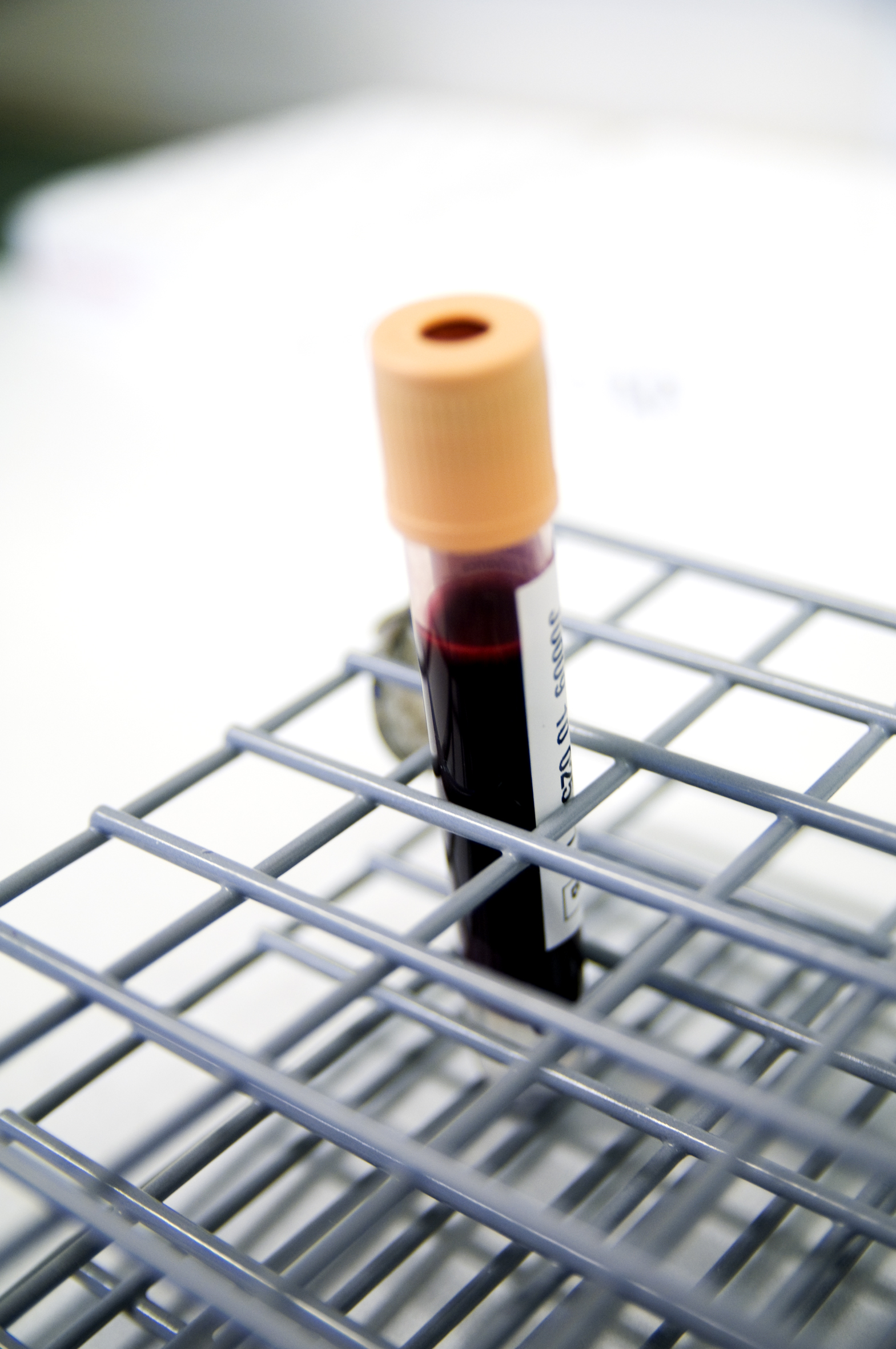 Et nærbilde av en sprøyte på et stativ