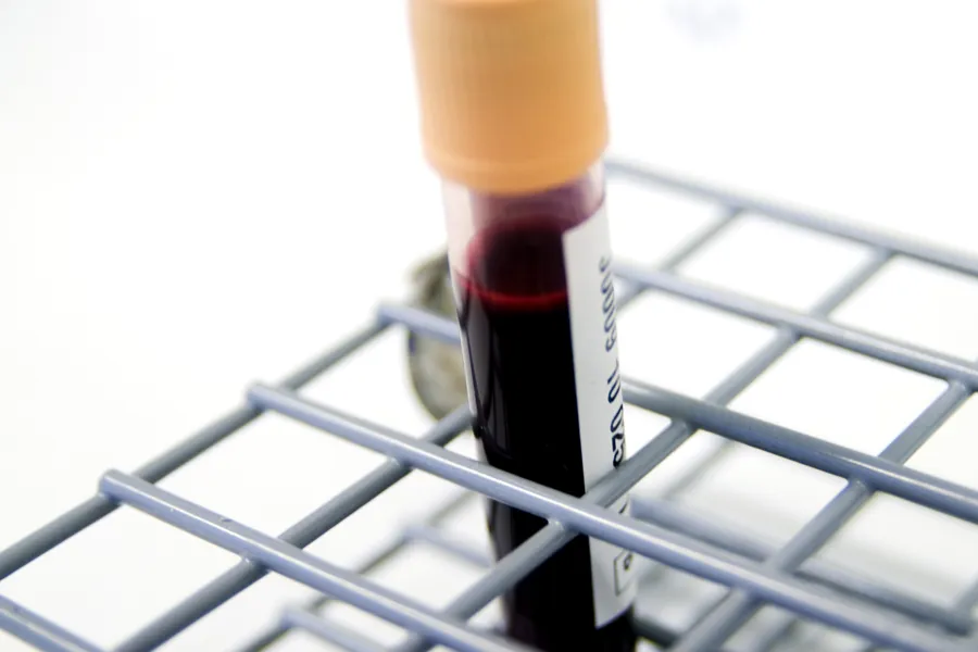 Et nærbilde av en sprøyte på et stativ