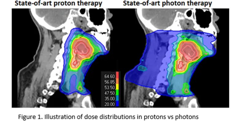 Illustrasjon som viser dosefordeling ved stråling med fotoner versus stråling med protoner. Illustrasjonen viser at protonstråling er mye mer målrettet og skader ikke omkringliggende vev i like stor grad som fotonstråling.