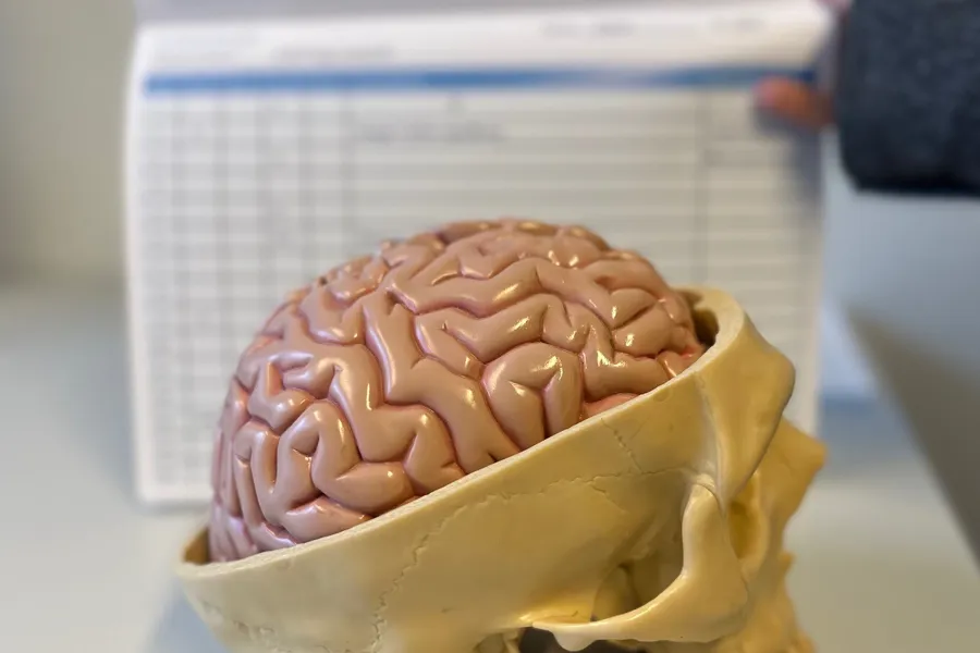 En hjerne med et kalender bak