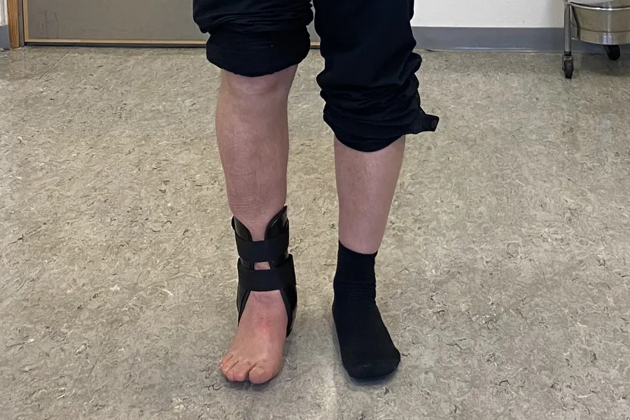 En person med ankelbrudd