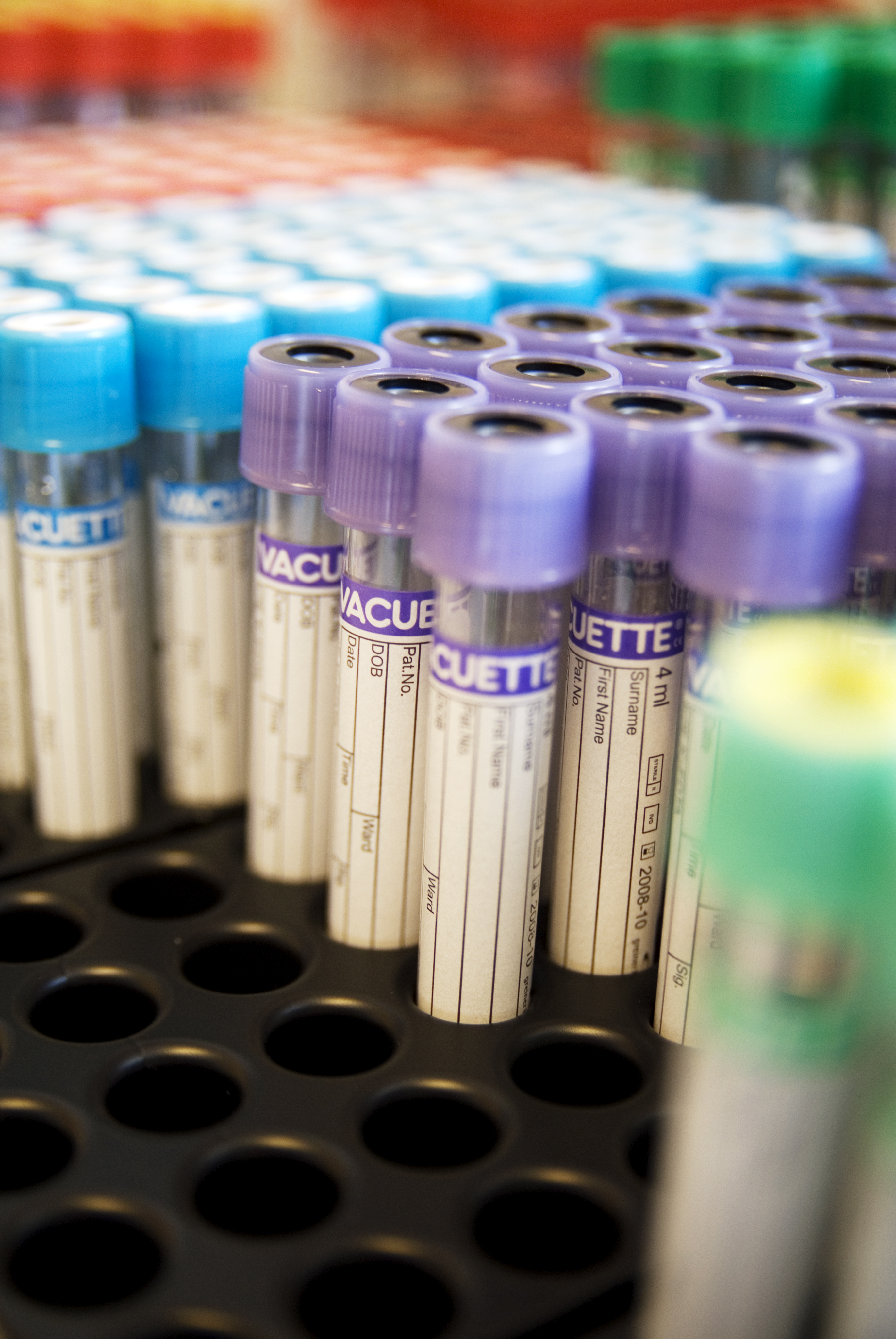 Blodprøveglass i forskjellige farger i et stativ.
