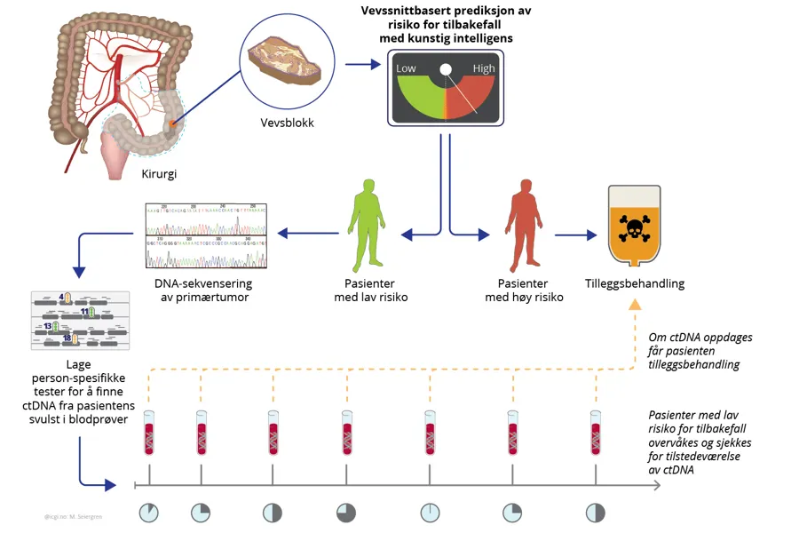 Oppfølging av pasienter med tykktarmskreft