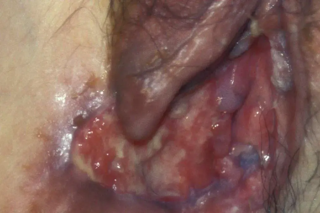 Et nærbilde av en persons munn