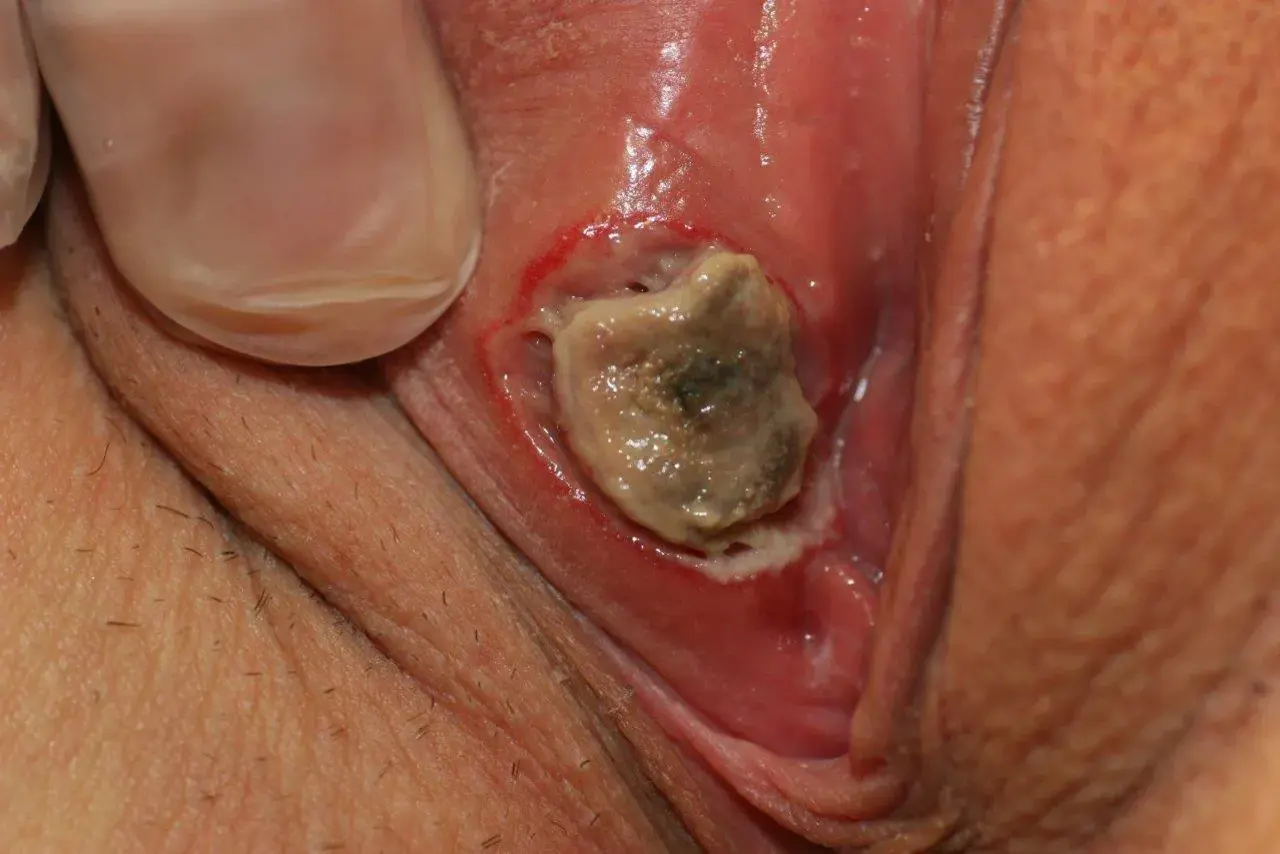 Nærbilde av et organ