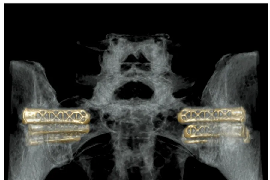 Røntgenbilde av bekkenledd