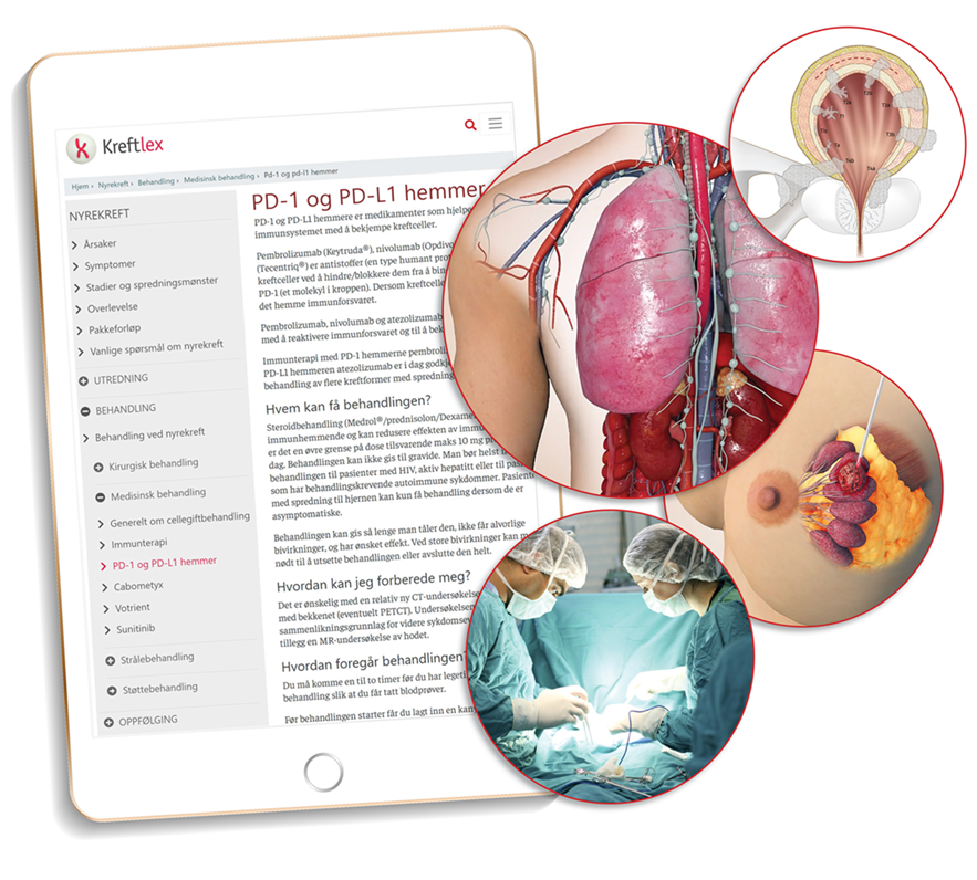 Oppslagsverket Kreftlex er rikt illustrert.