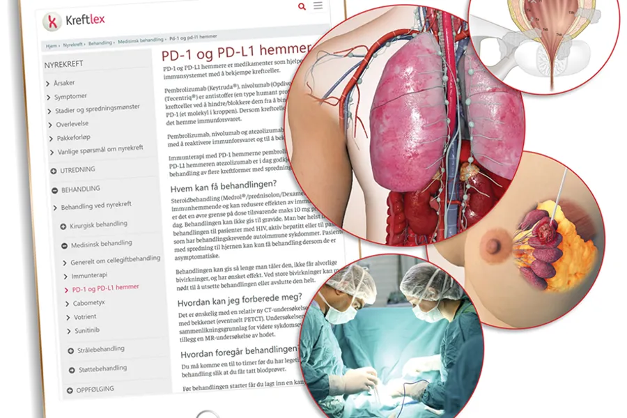 Oppslagsverket Kreftlex er rikt illustrert.