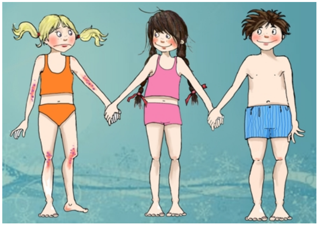 Barn med atopisk eksem som holder hender