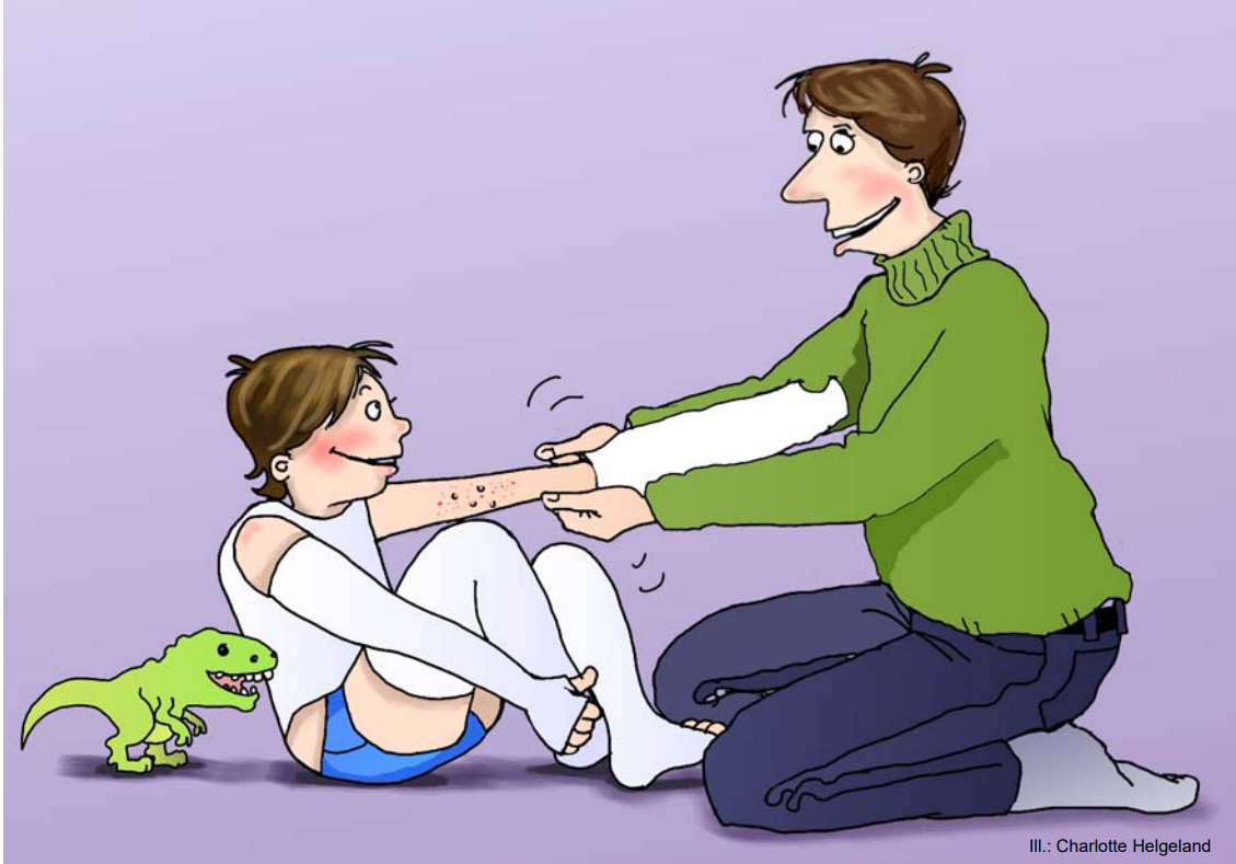 Far som legger våtbandasjer på barn