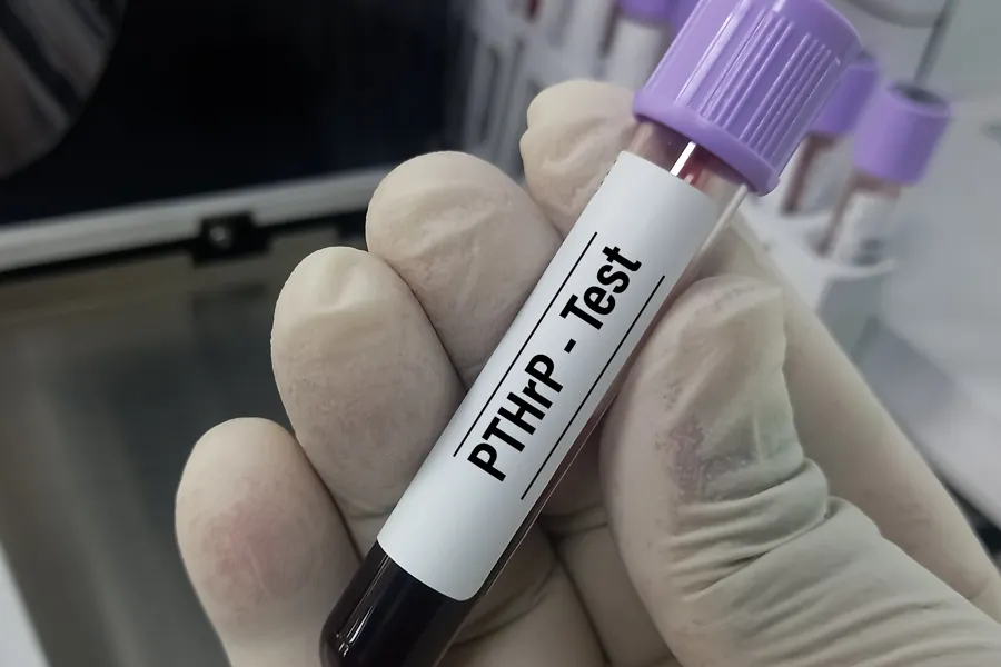 En hånd som holder et hvitt rør med et svart rør