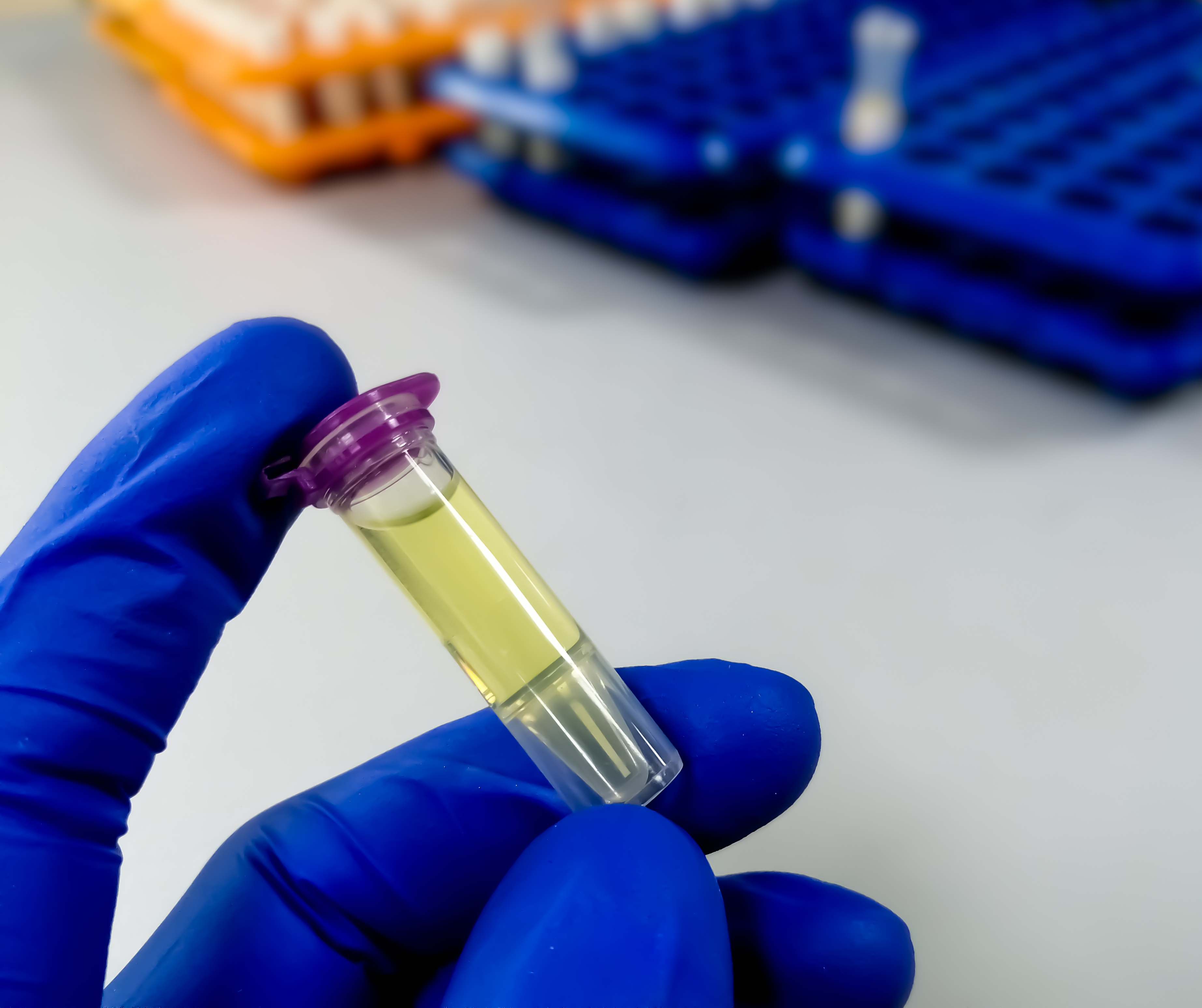 Et nærbilde av et stetoskop på et bord