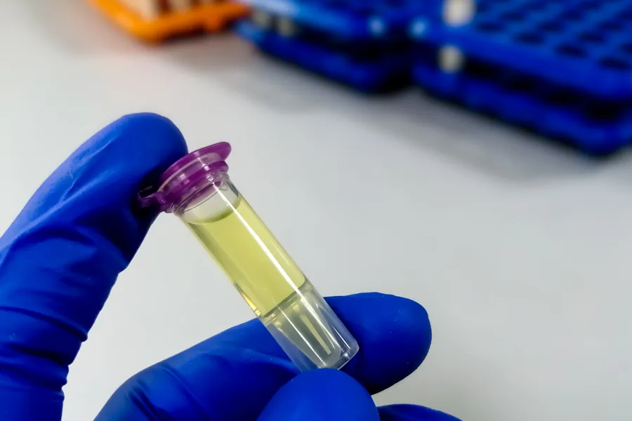 Et nærbilde av et stetoskop på et bord