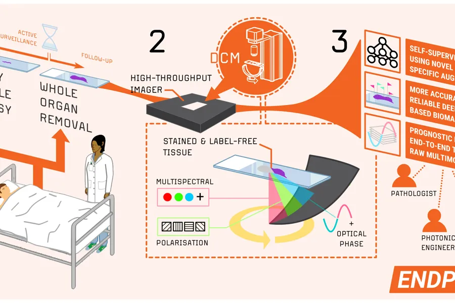 A visual representation with three steps – early needle biopsy and whole organ removal, analysis, and network.
