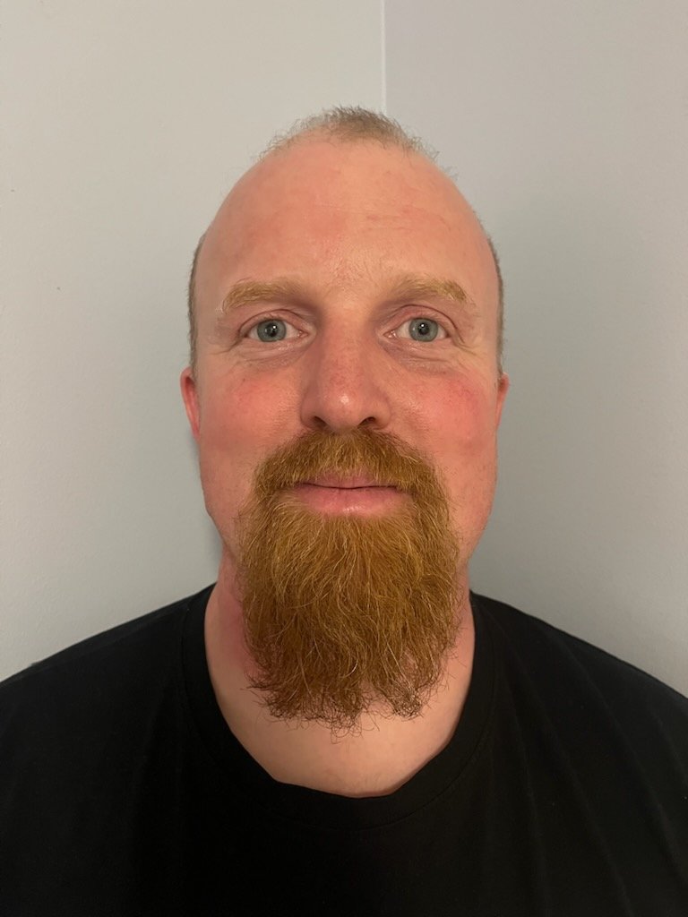 Brukerrepresentant fra Epilepsiforbundet Dravets syndrom.