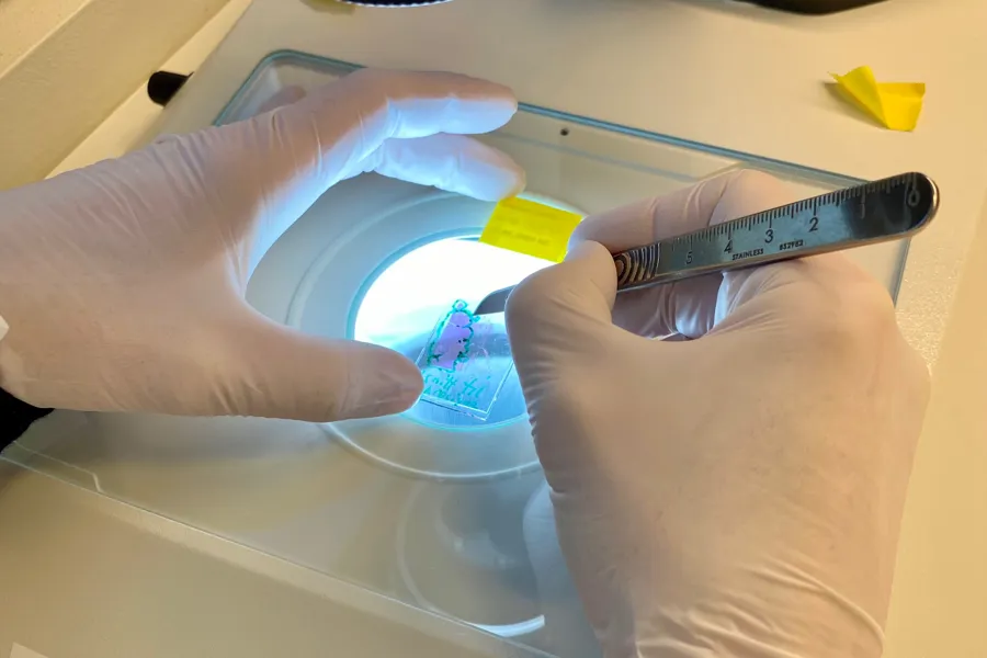 Hanskekledde hender med en skalpell, som skjærer tumorprøver under et mikroskop