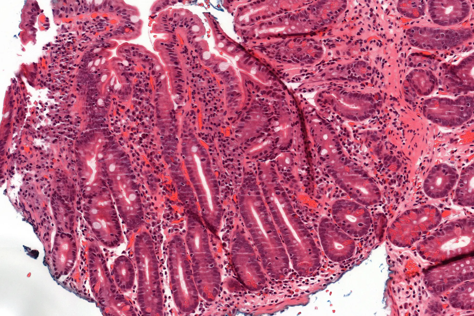En tynntarmsbiopsi slik den kan se ut i mikroskopet.