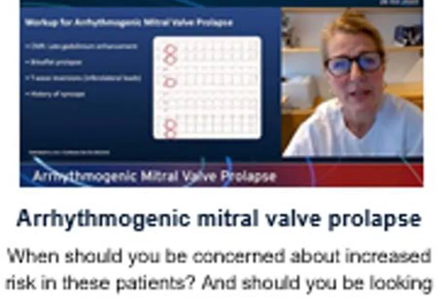 Graphical user interface