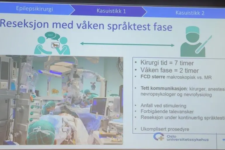 Presentasjon av epilepsioperasjon med våken testfase (våken kraniotomi)