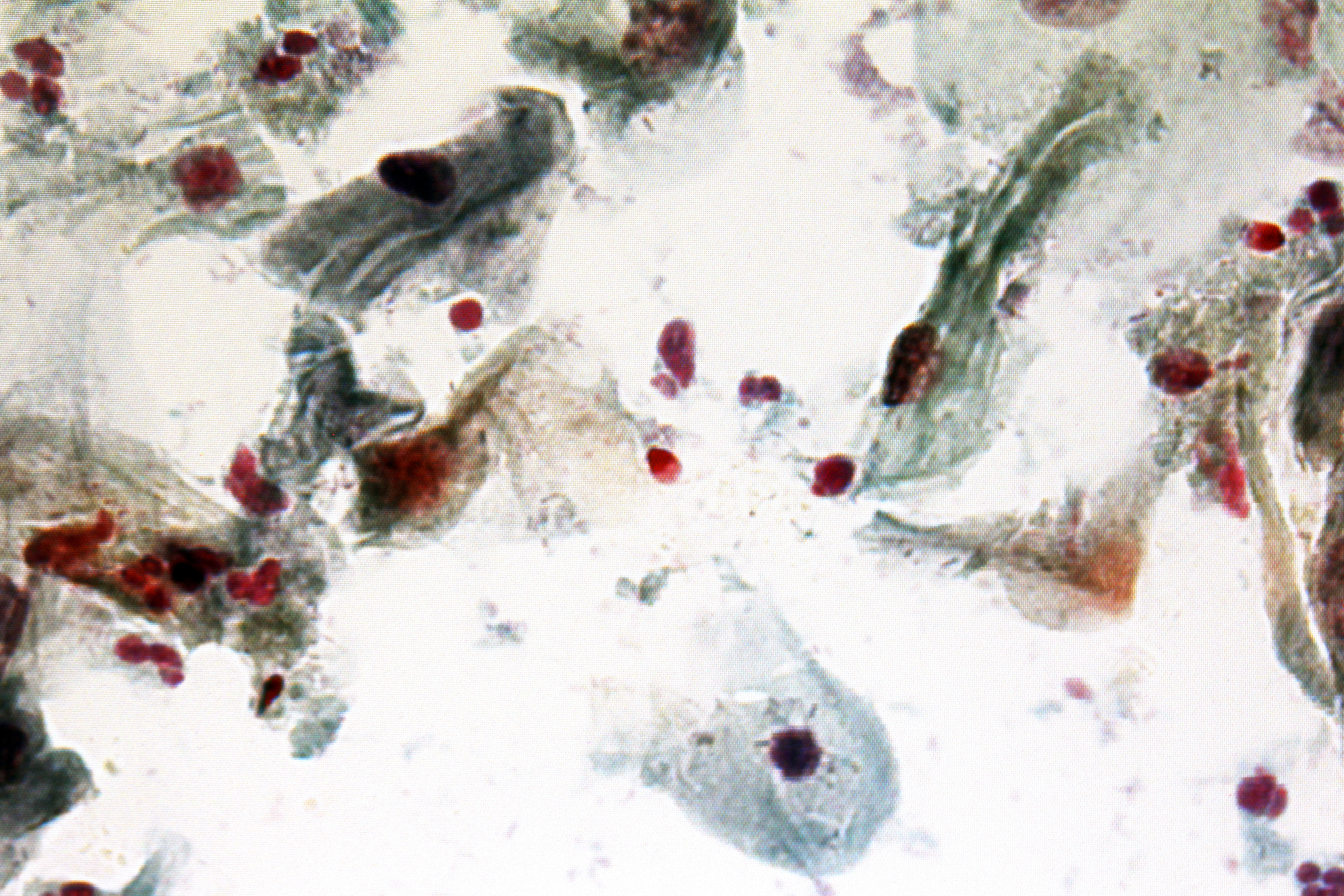 Et bilde som illustrerer hvordan en DNA profil fremstår som positive signaler med tilhørende tall før det gjøres om til en tallrekke. Og bilde av celler tatt med mikroskop.