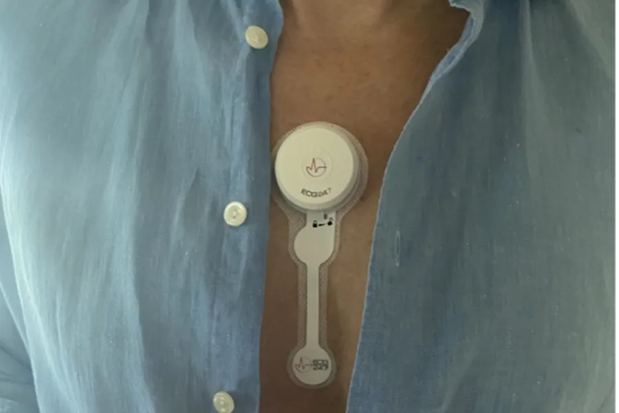 Plasteret med EKG-utstyr festet på brystkassen til en pasient. I hånden holder pasienten en mobiltelefon som viser hva EKG-plasteret har registrert.