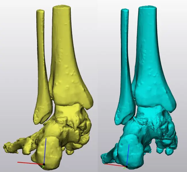 3D guide