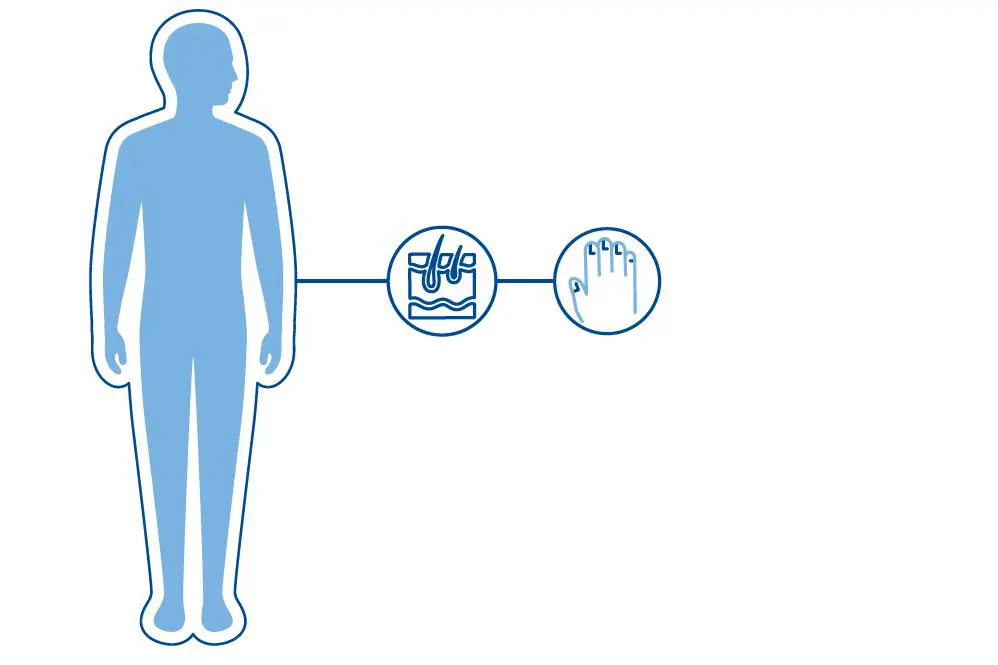 Diagnoseillustrasjon