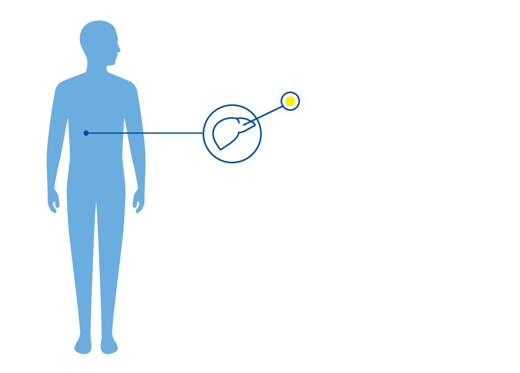 Diagnoseillustrasjon.