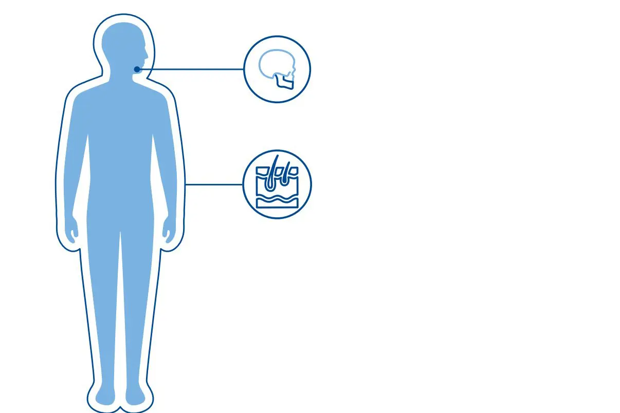 Diagnoseillustrasjon med et blått menneske med ikoner som viser kjeven og huden.