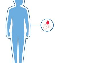 Illustrasjon av en blå menneskekropp med et uthevet symbol av en dråpe blod, som viser at faktor Xiii--mangel er en blødersykdom