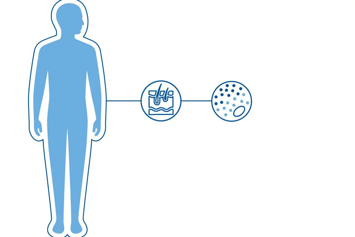 Diagnoseillustrasjon