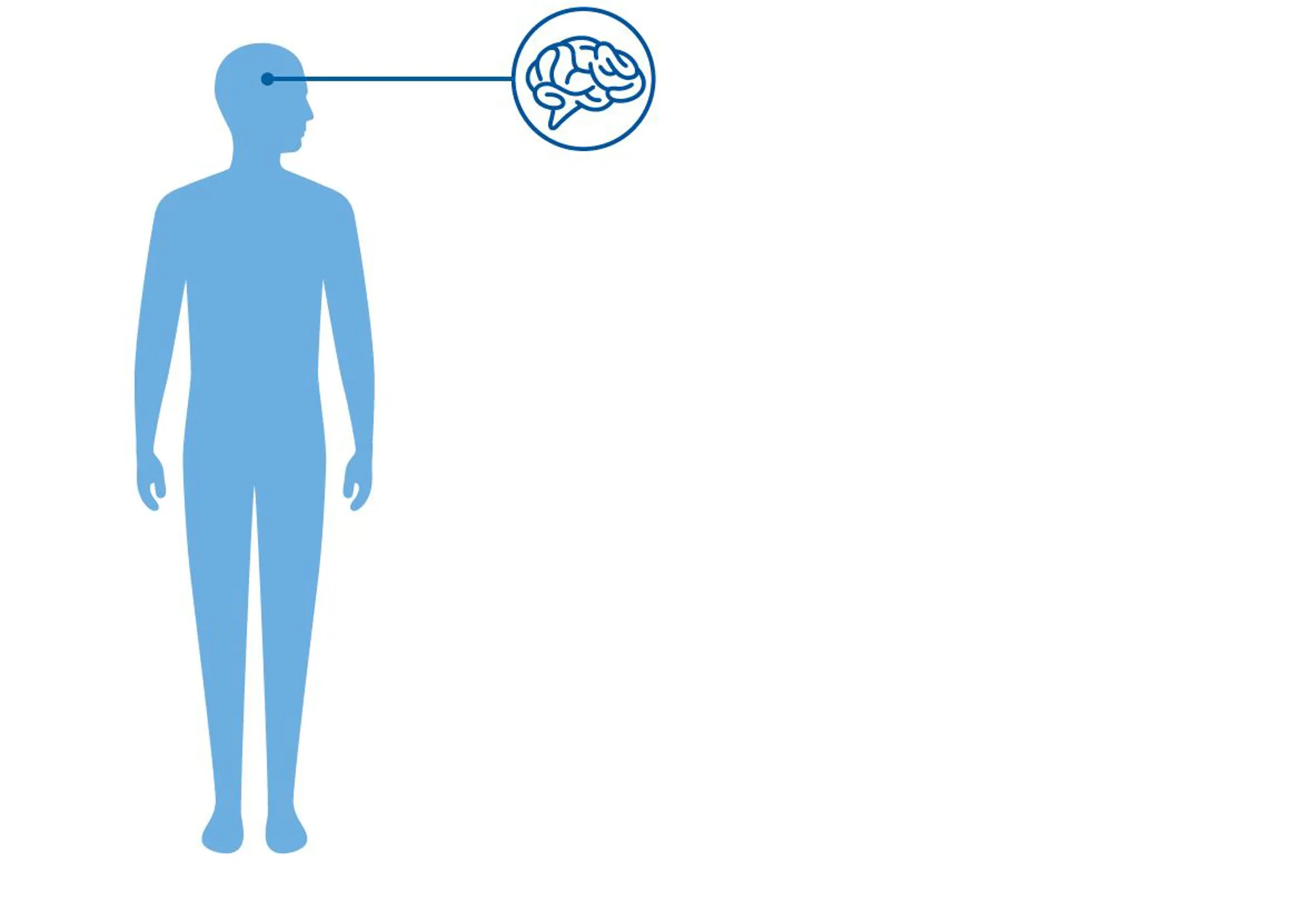 Huntingtons sykdom er en arvelig hjernesykdom. Diagnoseillustrasjon av Huntingtons sykdom