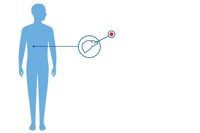 Diagnoseillustrasjon.