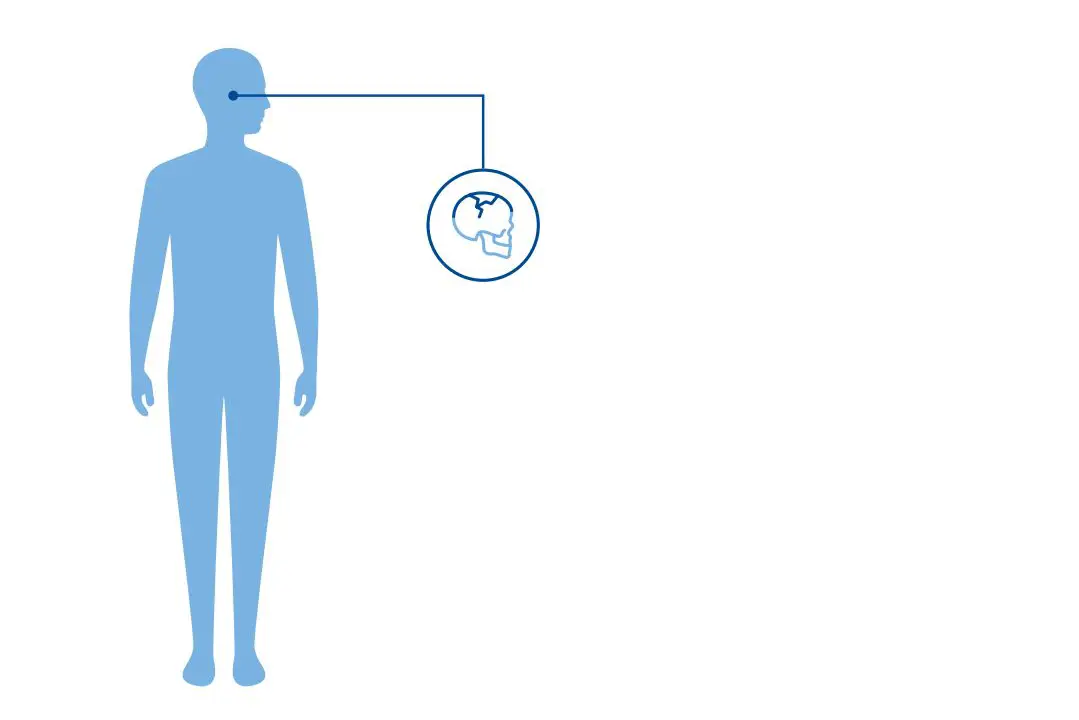 Diagnoseillustrasjon