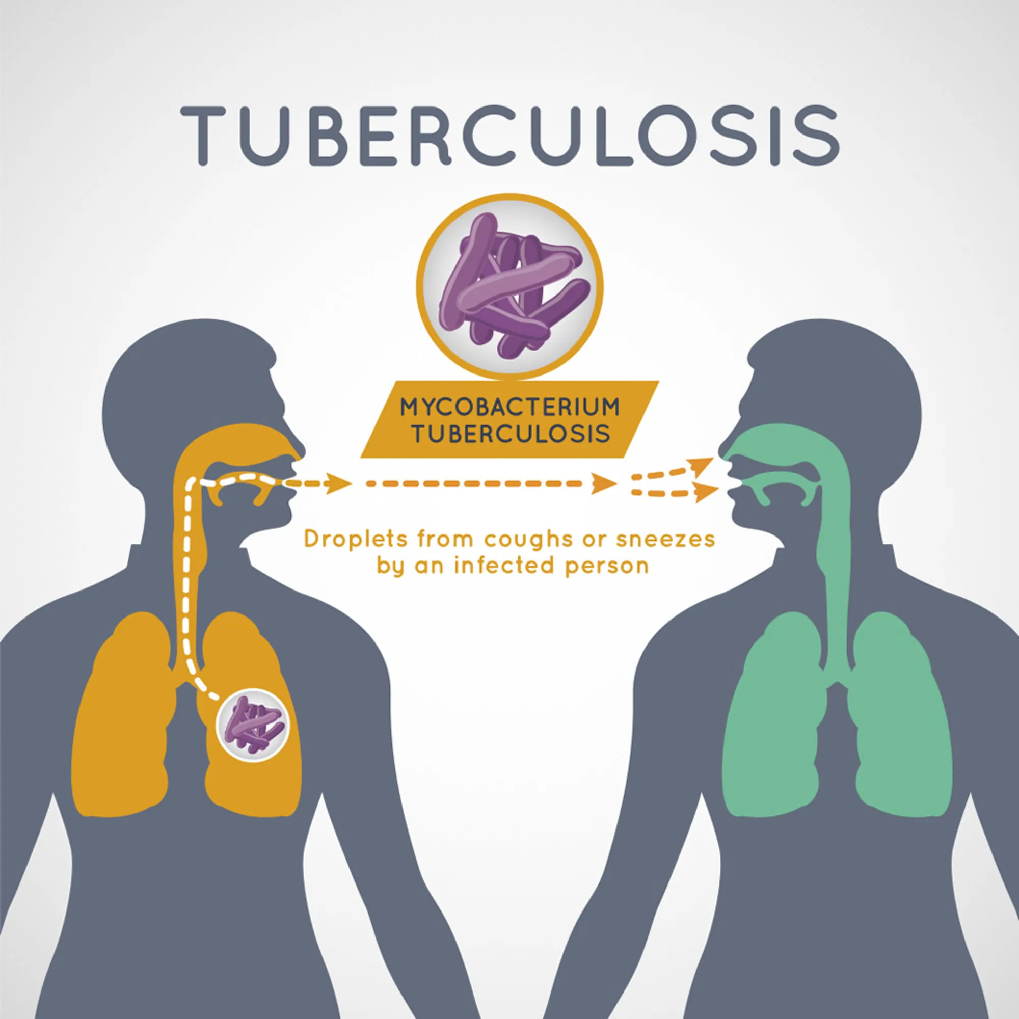 Figur tuberkulose