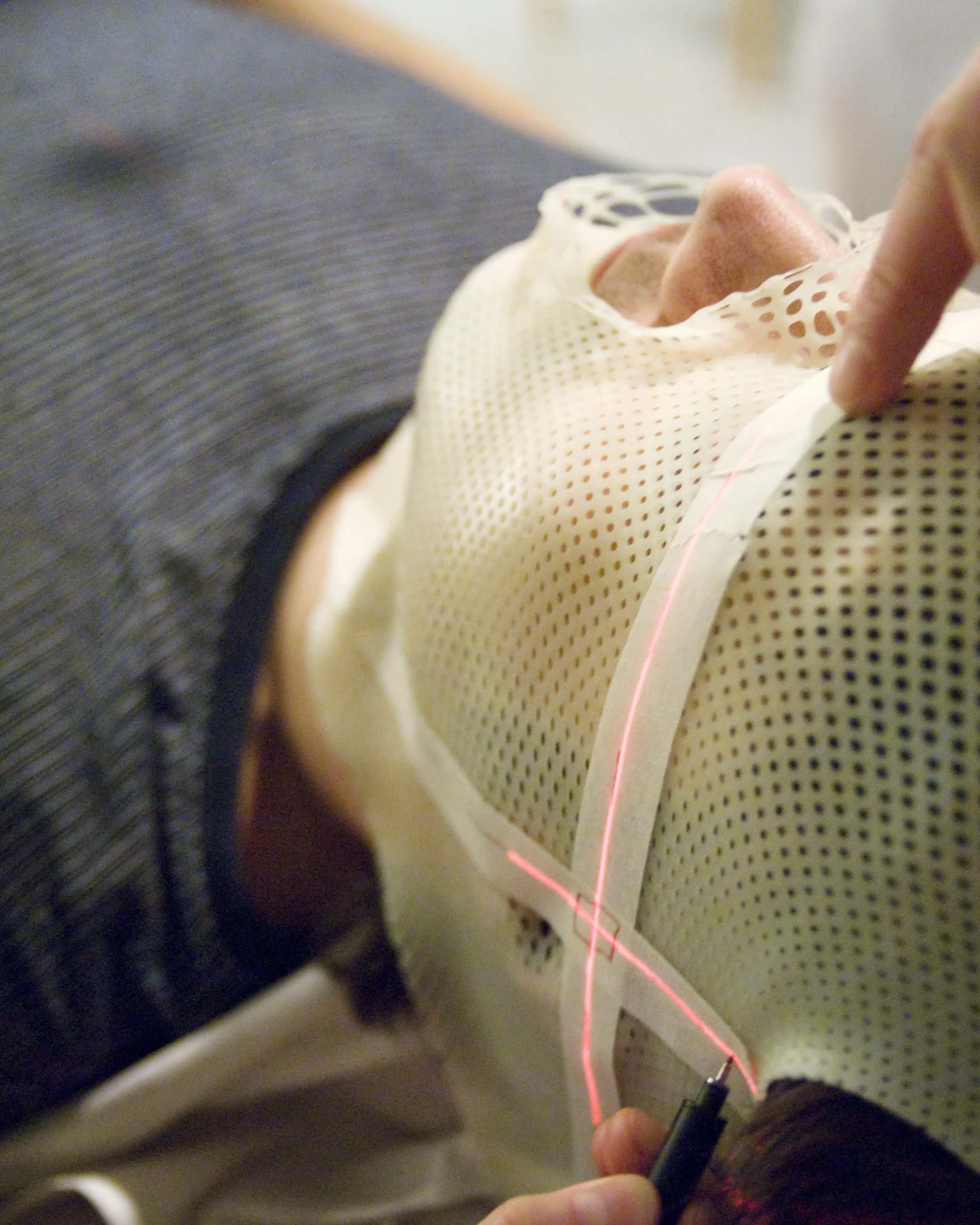 Bilde av pas stråleterapi