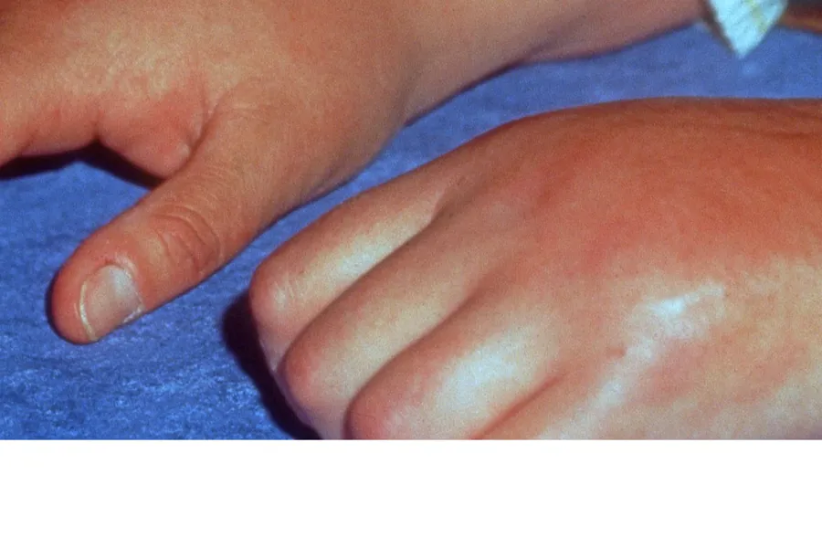 Et nærbilde av en persons hånd som holder en fot