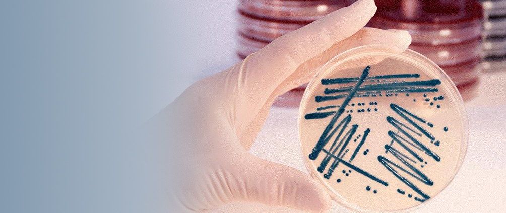 Bilde av dyrkningsskål