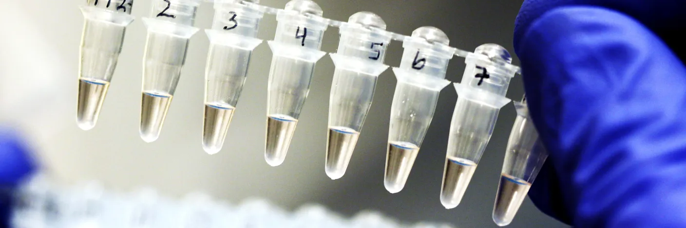 BIlde av en hånd med en rad med pipetter