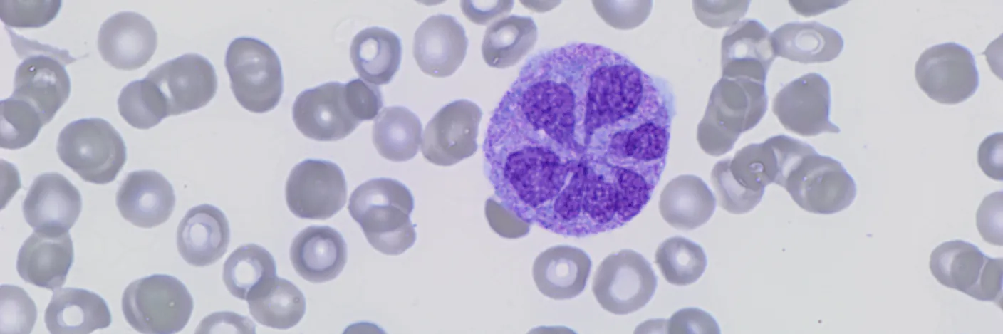 Blomstrende monocytt