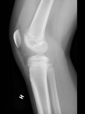 Et nærbilde av en menneskekropp