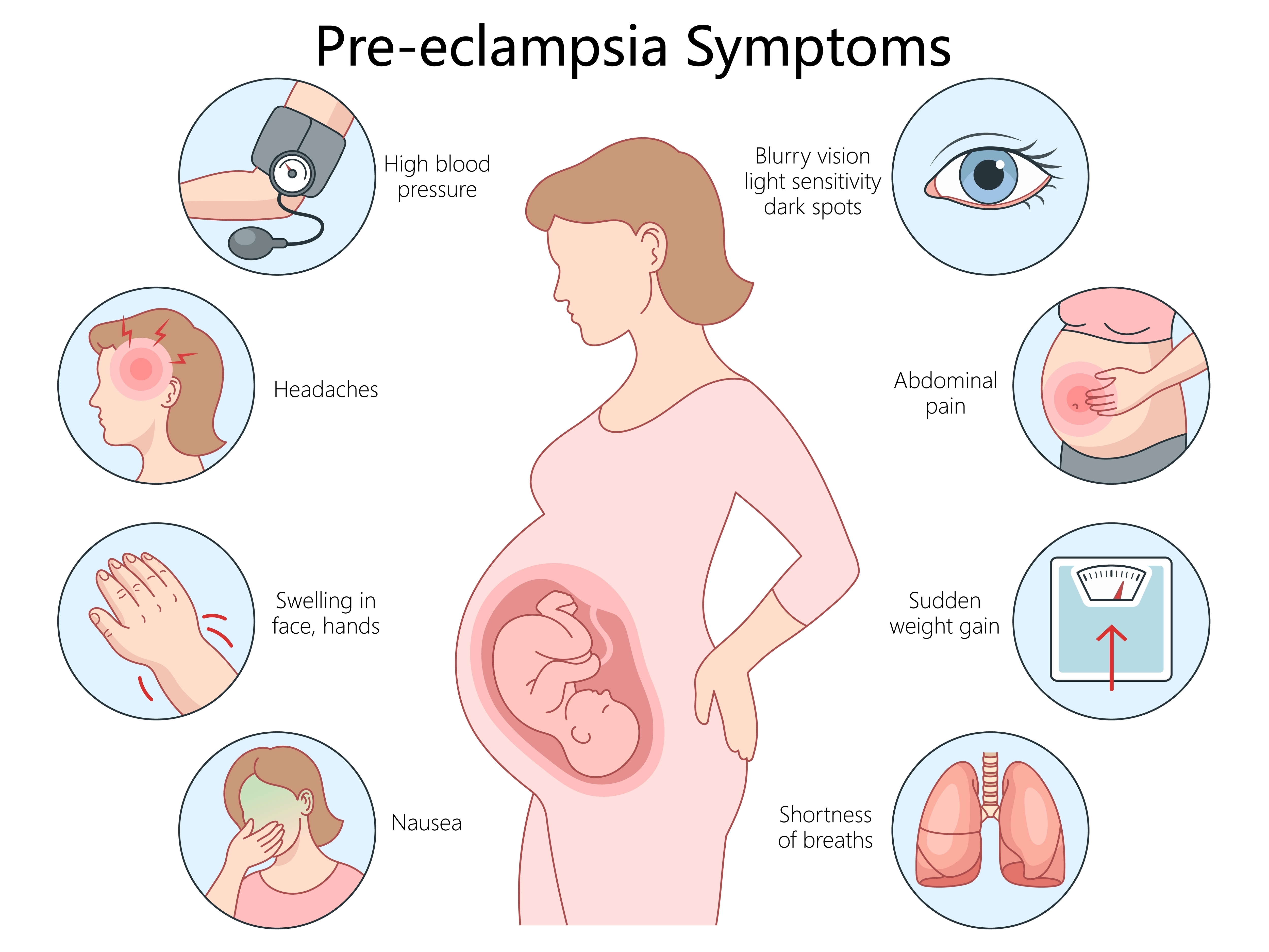 Diagram av gravid kvinne
