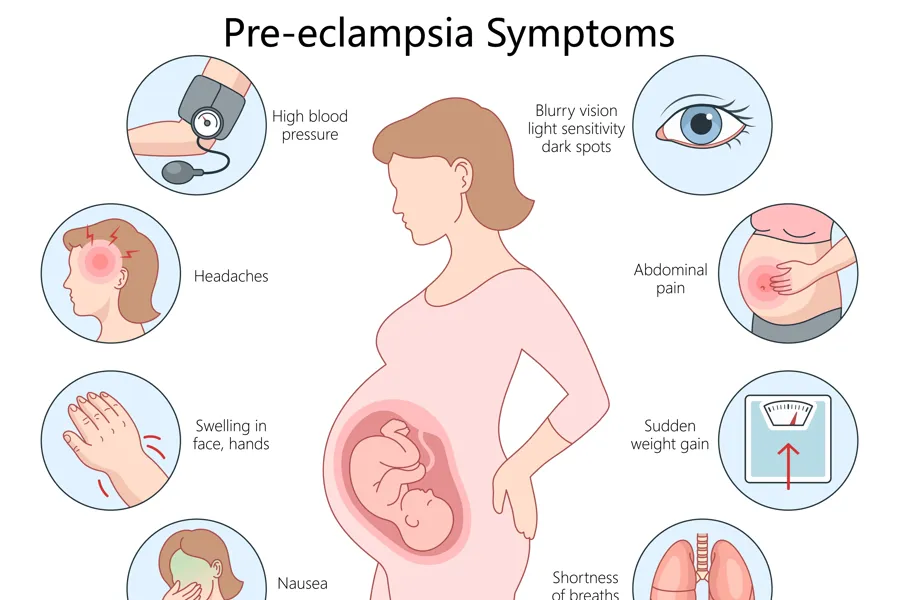 Diagram av gravid kvinne