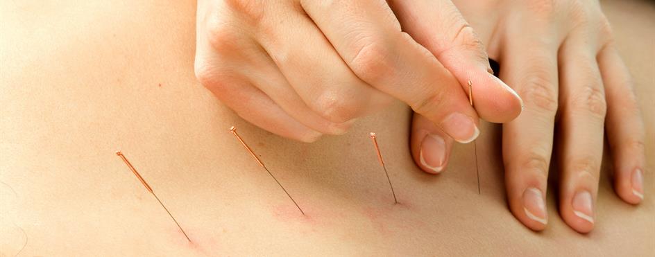 Et nærbilde av hender som holder en nål