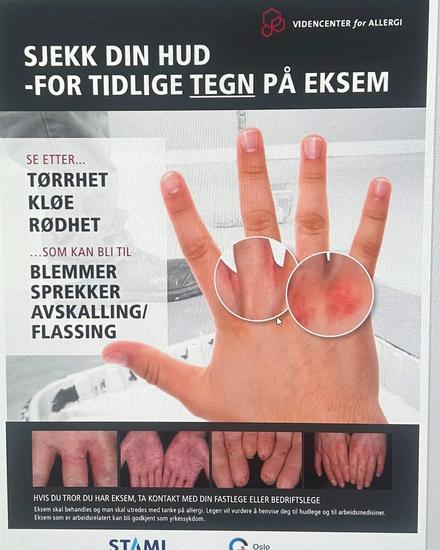 Et skjermbilde av en hånd