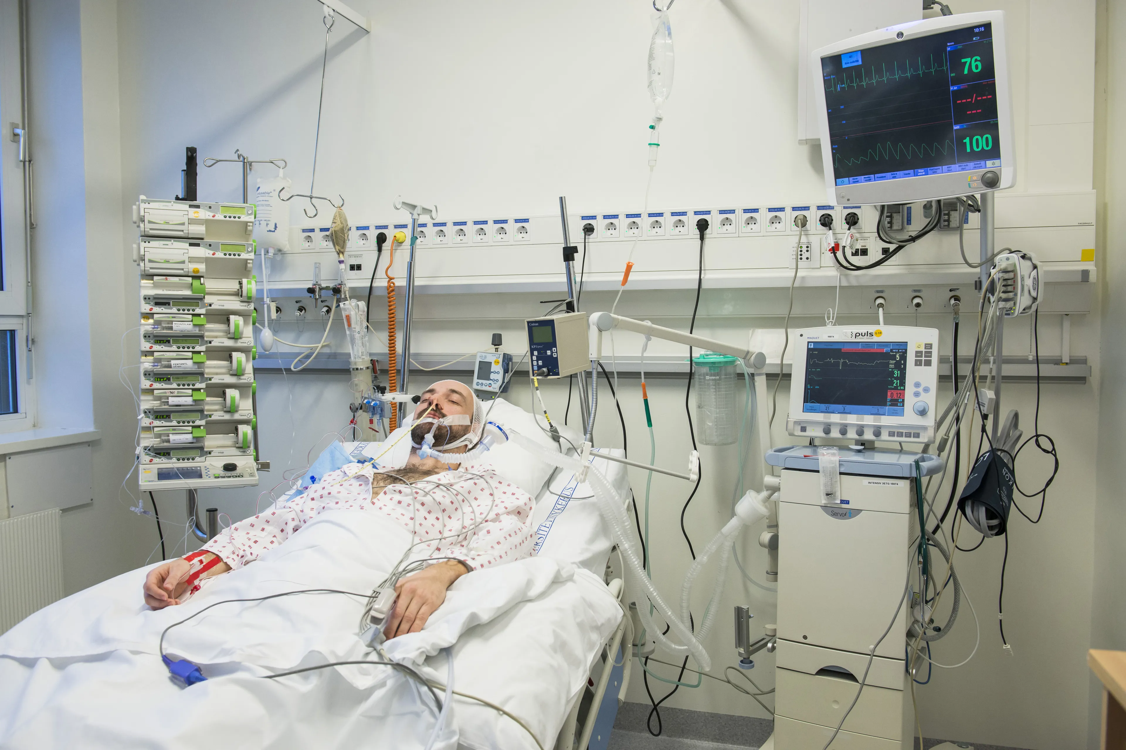 Nevrointensivpasient i seng