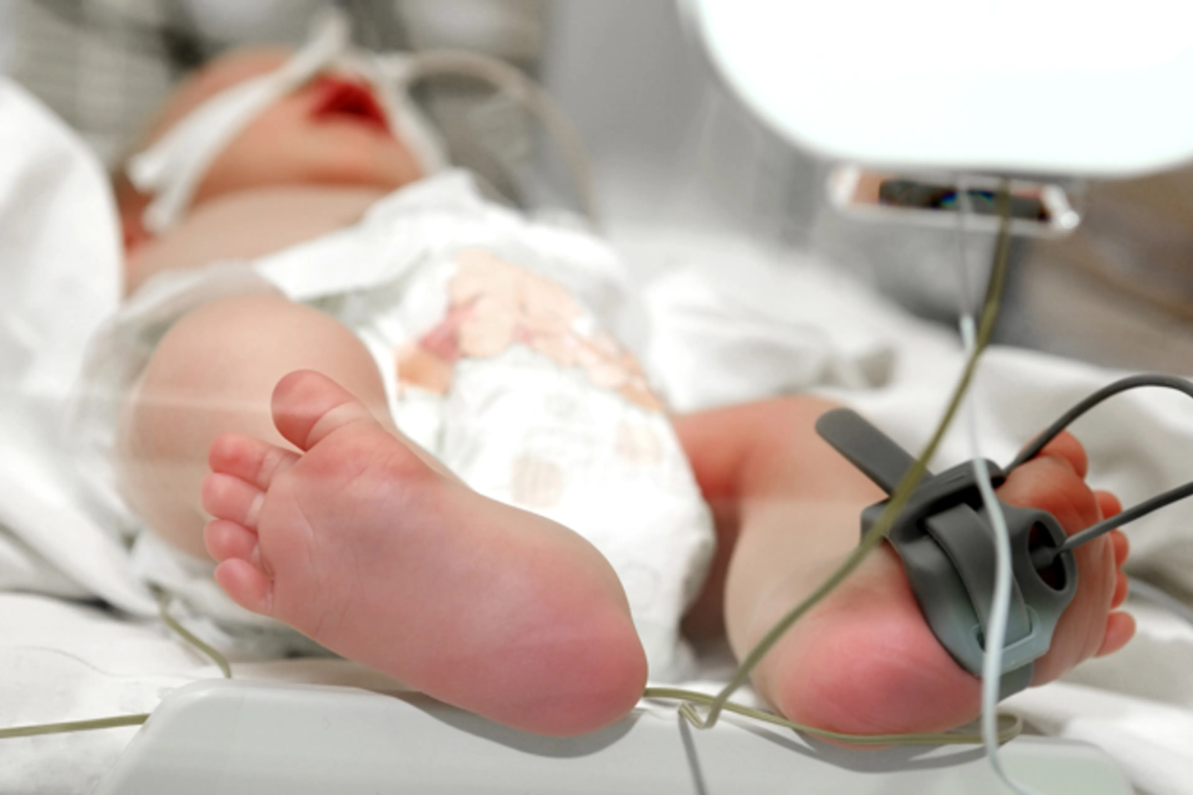 En prematurt barn som sover i en kuvøse