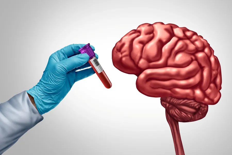 En persons hånd som holder en sprøyte med en rød væske